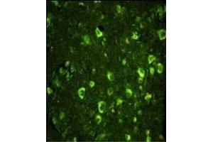 Immunofluorescence analysis of ABI1 Antibody (N-term) with paraffin-embedded human brain tissue. (ABI1 Antikörper  (N-Term))