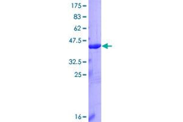 IL36A/IL1F6 Protein (AA 1-158) (GST tag)