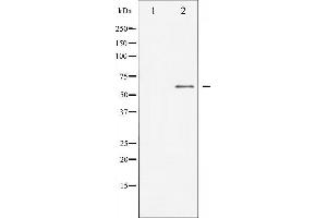 Western blot analysis of Dab1 expression in HepG2 whole cell lysates,The lane on the left is treated with the antigen-specific peptide. (DAB1 Antikörper  (Internal Region))
