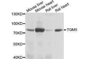 Western blot analysis of extracts of various cell lines, using TGM5 antibody. (Transglutaminase 5 Antikörper)
