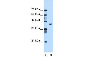 PGK1 antibody used at 1.