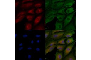 ABIN7094440 and ABIN7098488 staining  cells by IF/ICC. (Tenascin N Antikörper  (C-Term))