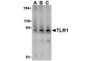 Western Blotting (WB) image for anti-Toll-Like Receptor 1 (TLR1) (N-Term) antibody (ABIN2479707)