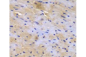 Immunohistochemistry of paraffin-embedded Mouse heart using SGCE Polyclonal Antibody at dilution of 1:200 (40x lens). (SGCE Antikörper)