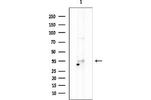 anti-RASD Family, Member 2 (RASD2) (Internal Region) antibody