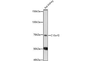 Western blot analysis of extracts of Rat kidney, using C10orf2 antibody (ABIN6129358, ABIN6137715, ABIN6137717 and ABIN6220923) at 1:1000 dilution.