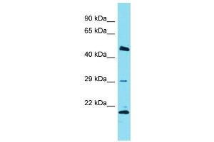 Host:  Rabbit  Target Name:  Relb  Sample Type:  Rat Thymus lysates  Antibody Dilution:  1. (RELB Antikörper  (C-Term))