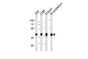 ALDOC Antibody (C-term) ABIN1882208 western blot analysis in 293,CEM cell line and mouse brain,cerebellum tissue lysates (35 μg/lane). (ALDOC Antikörper)