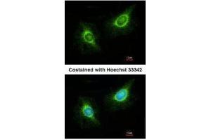 ICC/IF Image Immunofluorescence analysis of methanol-fixed HeLa, using Laminin beta 3, antibody at 1:200 dilution. (Laminin beta 3 Antikörper)