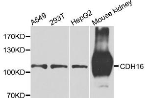 Western blot analysis of extracts of various cell lines, using CDH16 antibody. (Cadherin-16 Antikörper)