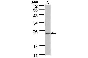 WB Image Sample (30 ug of whole cell lysate) A: 293T 12% SDS PAGE antibody diluted at 1:1000 (NDUFAF4 Antikörper  (full length))