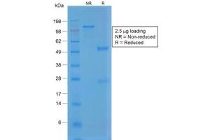 SDS-PAGE analysis of purified, BSA-free recombinant vWF antibody (clone VWF/1859R) as confirmation of integrity and purity. (Rekombinanter VWF Antikörper  (AA 1815-1939))