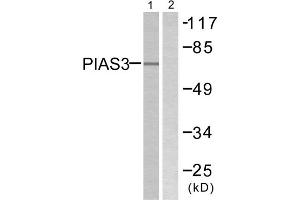 Western blot analysis of extracts from 293 cells, treated with UV (5mins), using PIAS3 antibody. (PIAS3 Antikörper  (N-Term))