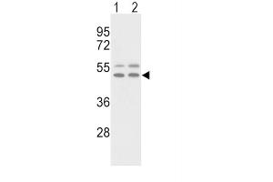 Western Blotting (WB) image for anti-Vitronectin (VTN) antibody (ABIN3003231)