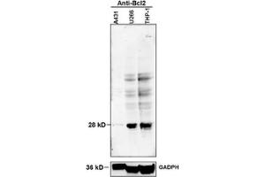 Image submitted by OWL Validation Program. (Bcl-2 Antikörper  (pSer70))