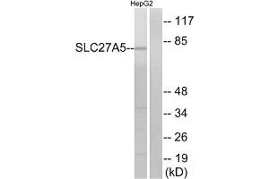 Western Blotting (WB) image for anti-Solute Carrier Family 27 (Fatty Acid Transporter), Member 5 (SLC27A5) (Internal Region) antibody (ABIN1850922) (SLC27A5 Antikörper  (Internal Region))