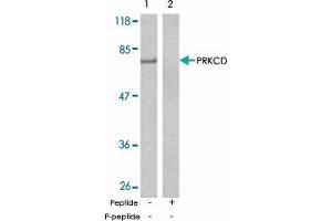 Western blot analysis of extract from MCF-7 cells using PRKCD polyclonal antibody  . (PKC delta Antikörper)