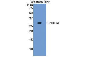 Western blot analysis of the recombinant protein. (MIB2 Antikörper  (AA 546-784))
