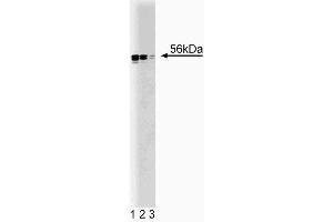 Western blot analysis of Lyn on HEL (human erythroleukemia cell line) lysate. (LYN Antikörper  (AA 1-138))