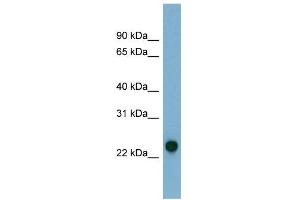 WB Suggested Anti-AK3 Antibody Titration: 0. (Adenylate Kinase 3 Antikörper  (N-Term))
