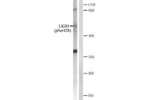 Western blot analysis of extracts from CV-1 cells treated with forsklin. (LKB1 Antikörper  (pSer428))