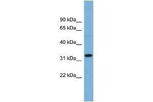 Human OVCAR-3; WB Suggested Anti-OR6C68 Antibody Titration: 0. (OR6C68 Antikörper  (N-Term))
