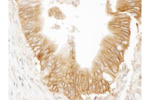 anti-Adenylate Cyclase 9 (ADCY9) (AA 1303-1353) antibody