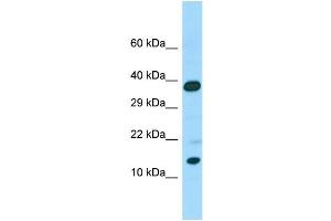 Host: Rabbit Target Name: CALML6 Sample Type: Placenta lysates Antibody Dilution: 1. (CALML6 Antikörper  (C-Term))