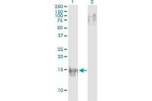 Western Blot analysis of APOB expression in transfected 293T cell line by APOB monoclonal antibody (M14), clone 3E5. (APOB Antikörper  (AA 28-127))