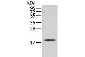 Western blot analysis of Mouse skeletal muscle tissue using TNNC1 Polyclonal Antibody at dilution of 1:250 (TNNC1 Antikörper)
