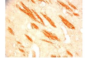 Mouse brain tissue was stained by Rabbit Anti-Metasin (1-25) / KISS-1 (68-92) (Human) Serum