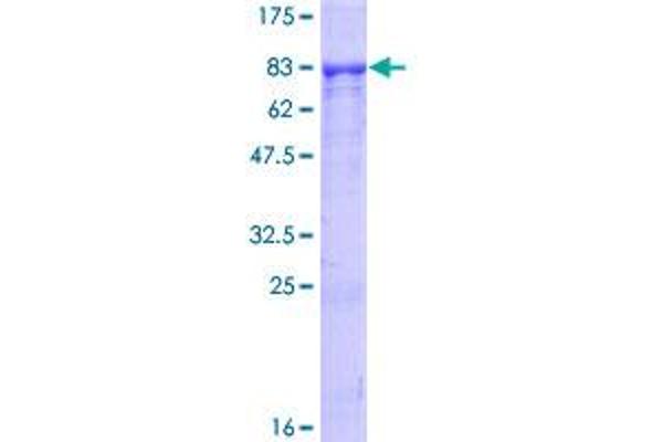 RIPK2 Protein (AA 1-540) (GST tag)