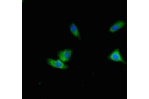 Immunofluorescent analysis of Hela cells using ABIN7150586 at dilution of 1:100 and Alexa Fluor 488-congugated AffiniPure Goat Anti-Rabbit IgG(H+L) (ALG12 Antikörper  (AA 367-422))