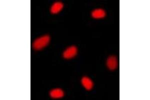 Immunofluorescent analysis of MGMT staining in T98G cells. (MGMT Antikörper  (N-Term))
