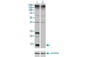 Western blot analysis of KCNE1 over-expressed 293 cell line, cotransfected with KCNE1 Validated Chimera RNAi (Lane 2) or non-transfected control (Lane 1). (KCNE1 Antikörper  (AA 67-129))