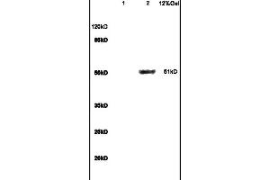Lane 1: mouse brain lysates Lane 2: mouse liver lysates probed with Anti GCK/Glucokinase Polyclonal Antibody, Unconjugated (ABIN734558) at 1:200 in 4C. (GCK Antikörper  (AA 101-200))