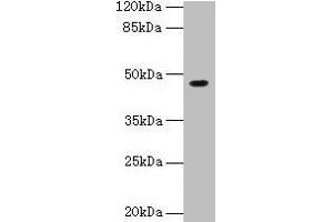 Western blot All lanes: NXF5 antibody at 4 μg/mL + HL60 whole cell lysate Secondary Goat polyclonal to rabbit IgG at 1/10000 dilution Predicted band size: 46, 43, 20, 36, 35 kDa Observed band size: 46 kDa (NXF5 Antikörper  (AA 1-200))