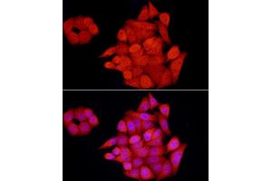 Immunofluorescence analysis of HeLa cells using GCH1 Rabbit pAb (ABIN7267525) at dilution of 1:100 (40x lens).
