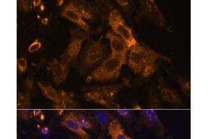 Immunofluorescence analysis of U-2 OS cells using TIMP2 Polyclonal Antibody at dilution of 1:100. (TIMP2 Antikörper)