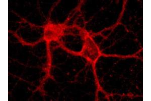 Indirect immunolabeling of hippocampus neurons (dilution 1 : 500) (Alpha-Protocadherin (AA 796-946) Antikörper)