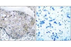 Immunohistochemistry (IHC) image for anti-VEGF Receptor 2 (VEGFR2) (AA 917-966), (pTyr951) antibody (ABIN1532000)