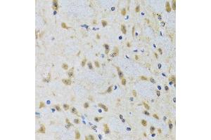 Immunohistochemistry of paraffin-embedded rat brain using ATG7 antibody. (ATG7 Antikörper  (AA 500-676))