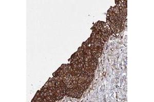 Immunohistochemical staining of human urinary bladder with SNX18 polyclonal antibody  shows strong cytoplasmic positivity in urothelial cells at 1:20-1:50 dilution. (SNX18 Antikörper)