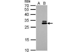 WB Image KLK7 antibody detects KLK7 protein by Western blot analysis. (Kallikrein 7 Antikörper)
