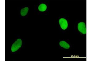 Immunofluorescence of purified MaxPab antibody to NOSIP on HeLa cell. (NOSIP Antikörper  (AA 1-301))