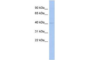 WB Suggested Anti-MSL3L1 Antibody Titration:  0. (MSL3 Antikörper  (Middle Region))