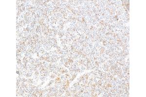 Immunohistochemistry (IHC) image for anti-REL proto-oncogene (c-Rel) (C-Term) antibody (ABIN7795771)