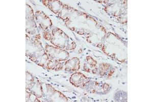 Immunohistochemistry (IHC) image for anti-Acyl-CoA Synthetase Long-Chain Family Member 3 (Acsl3) (AA 42-300) antibody (ABIN6136456)