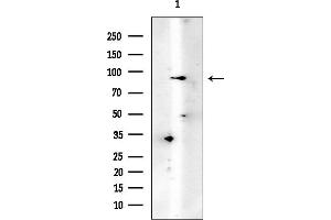 anti-YTH Domain Containing 1 (YTHDC1) antibody