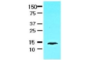 Western Blotting (WB) image for anti-Fatty Acid Binding Protein 1, Liver (FABP1) (AA 1-127), (N-Term) antibody (ABIN317518) (FABP1 Antikörper  (N-Term))